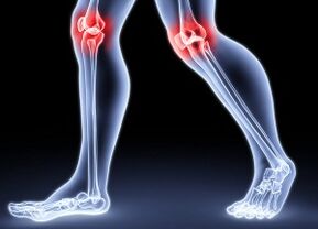 Razones para el desarrollo de la artesis de la rodilla